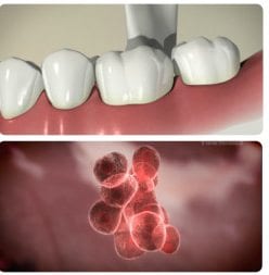 dental videos of tooth and tongue