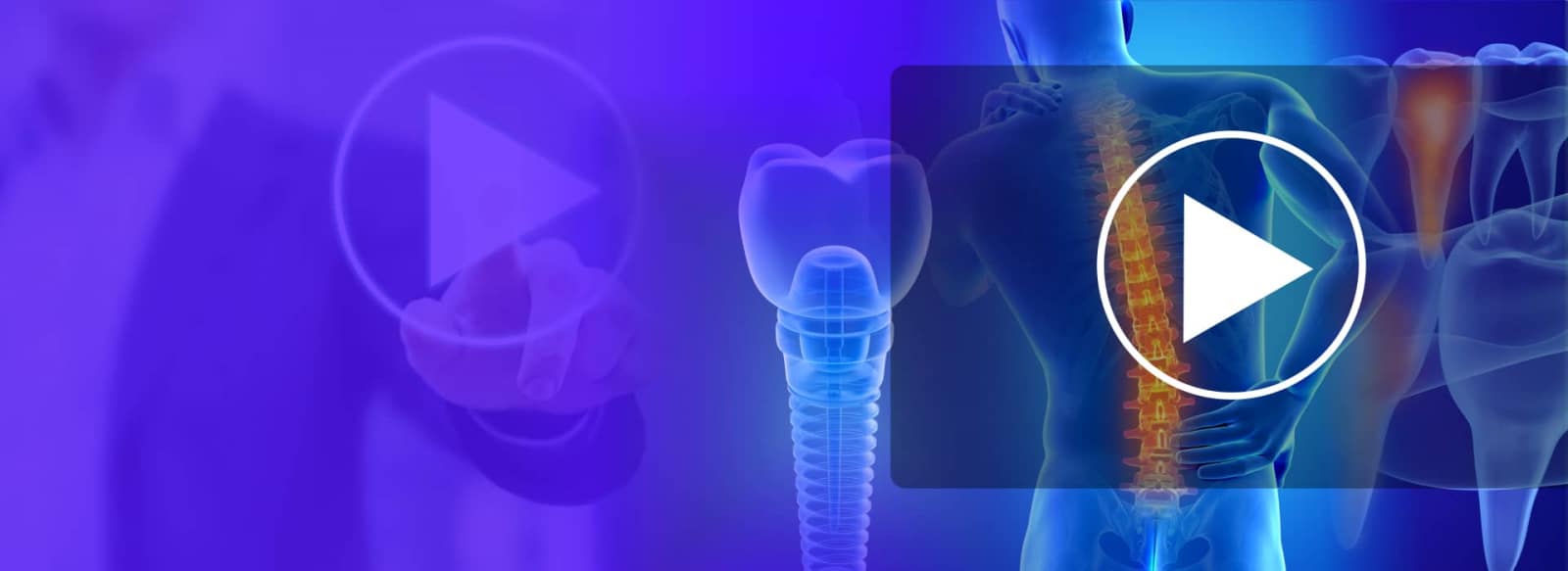 Background Image Showing Mix Of Tooth, Dental Implant And Video