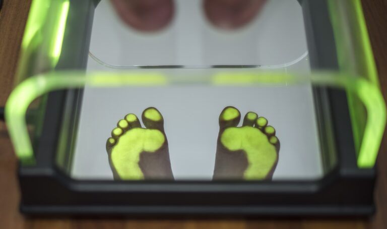 Feet scanning