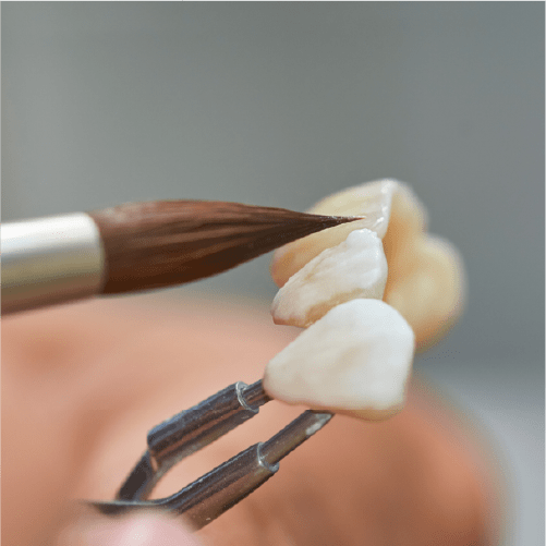 Hex Dental Lab Tooth