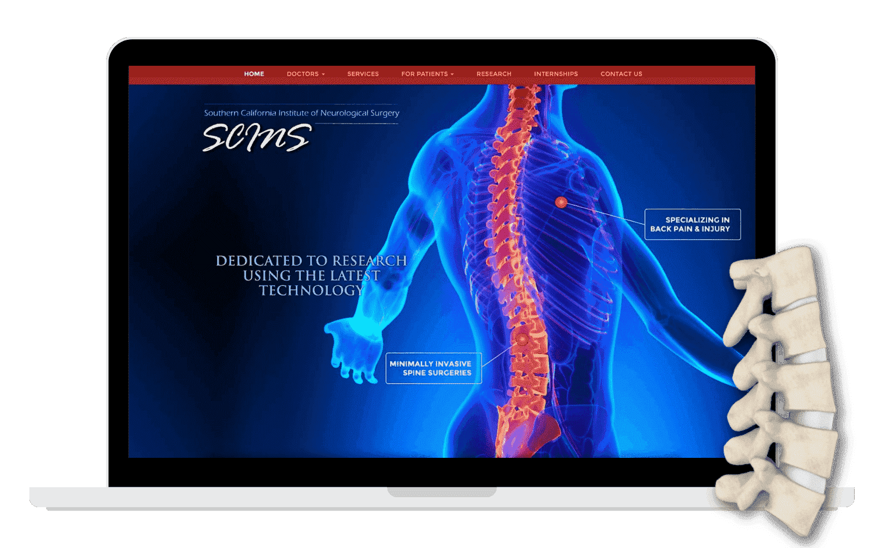 Custom radiology website design shown on a laptop